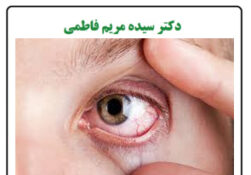 علایم کمبود ویتامین A