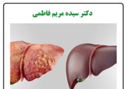 کبد چرب